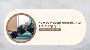 How To Prevent Arthritis After ACL Surgery